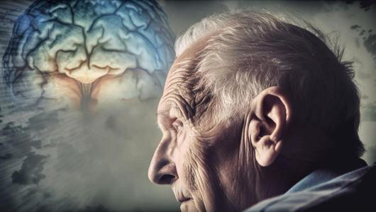 alzheimer demencia