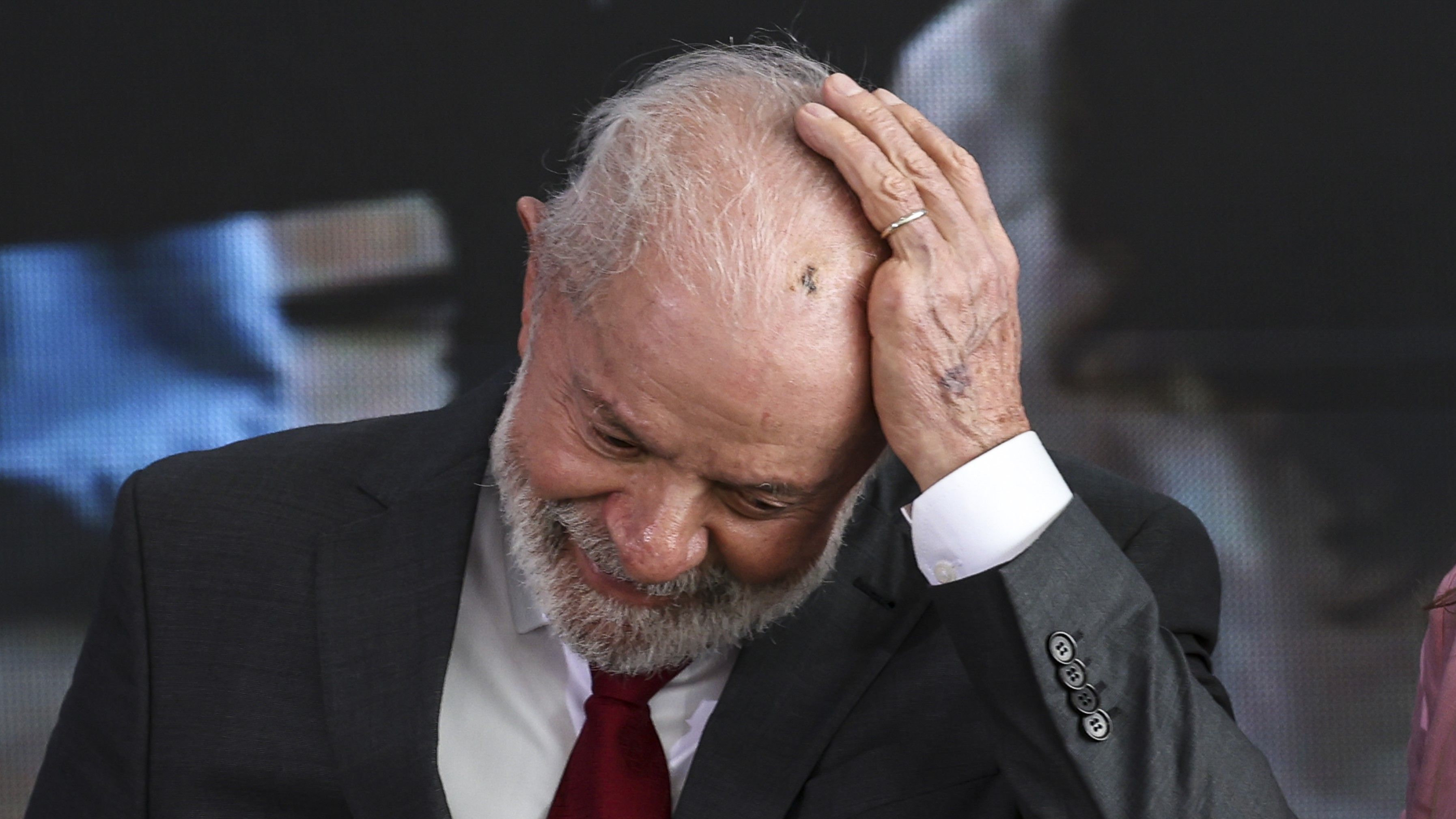 FOTOS: Lula expõe cicatriz em cabeça após cirurgia de emergência