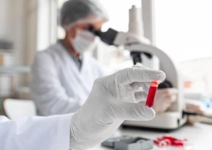 sangue exame de sangue infeccao sepse laboratorio