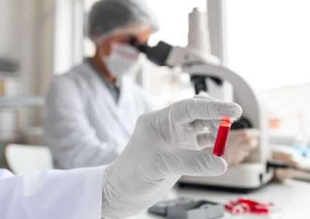 sangue exame de sangue infeccao sepse laboratorio