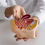 Cientistas descobrem alimento que pode prevenir câncer de intestino: 'Efeito supressor'