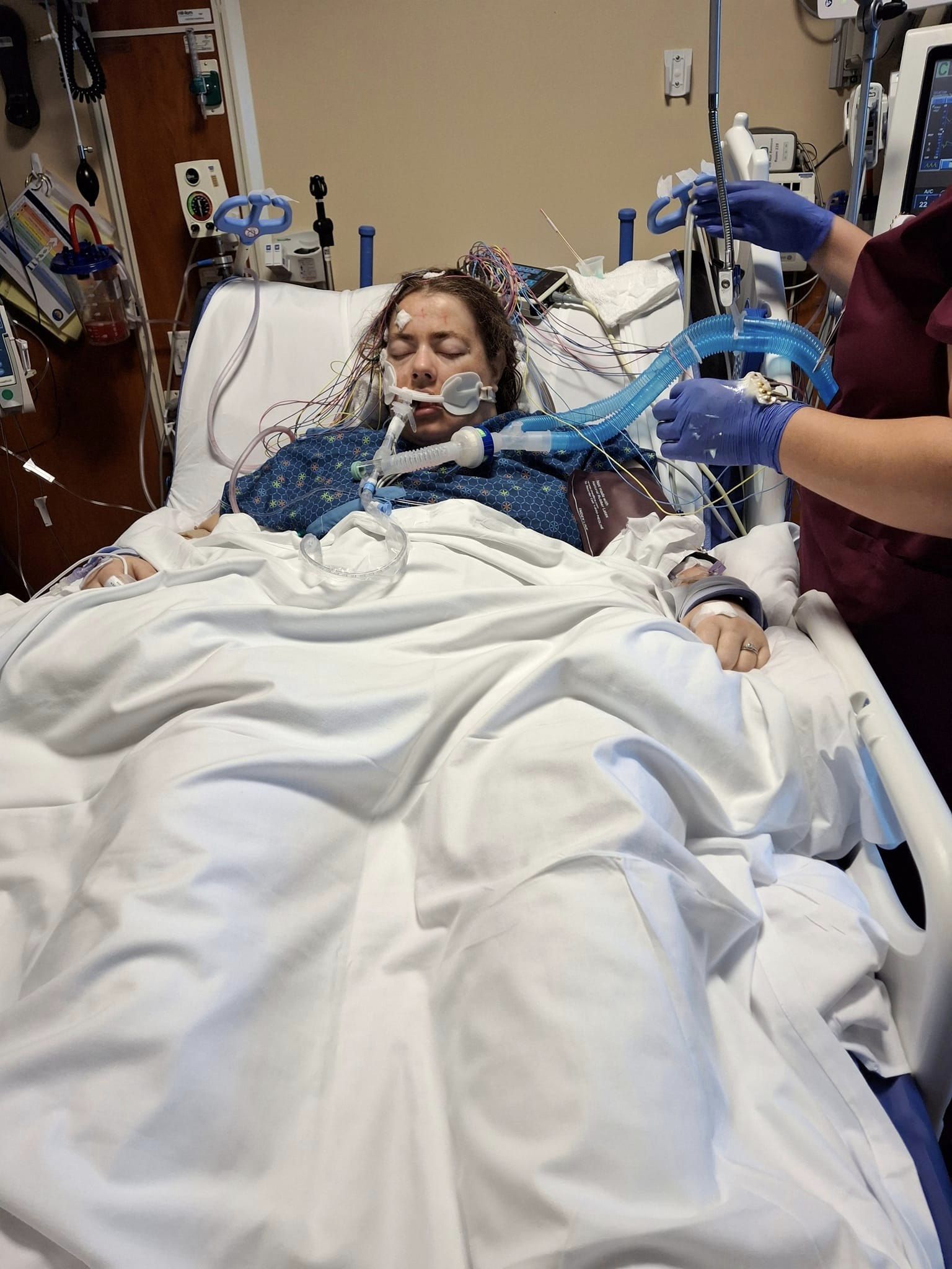 Mulher fica em coma após uso excessivo de 'vape': 'Uma gosma preta saindo do meu nariz e da minha boca'