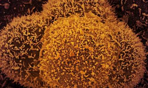 Imagem microscópica do Coronavírus