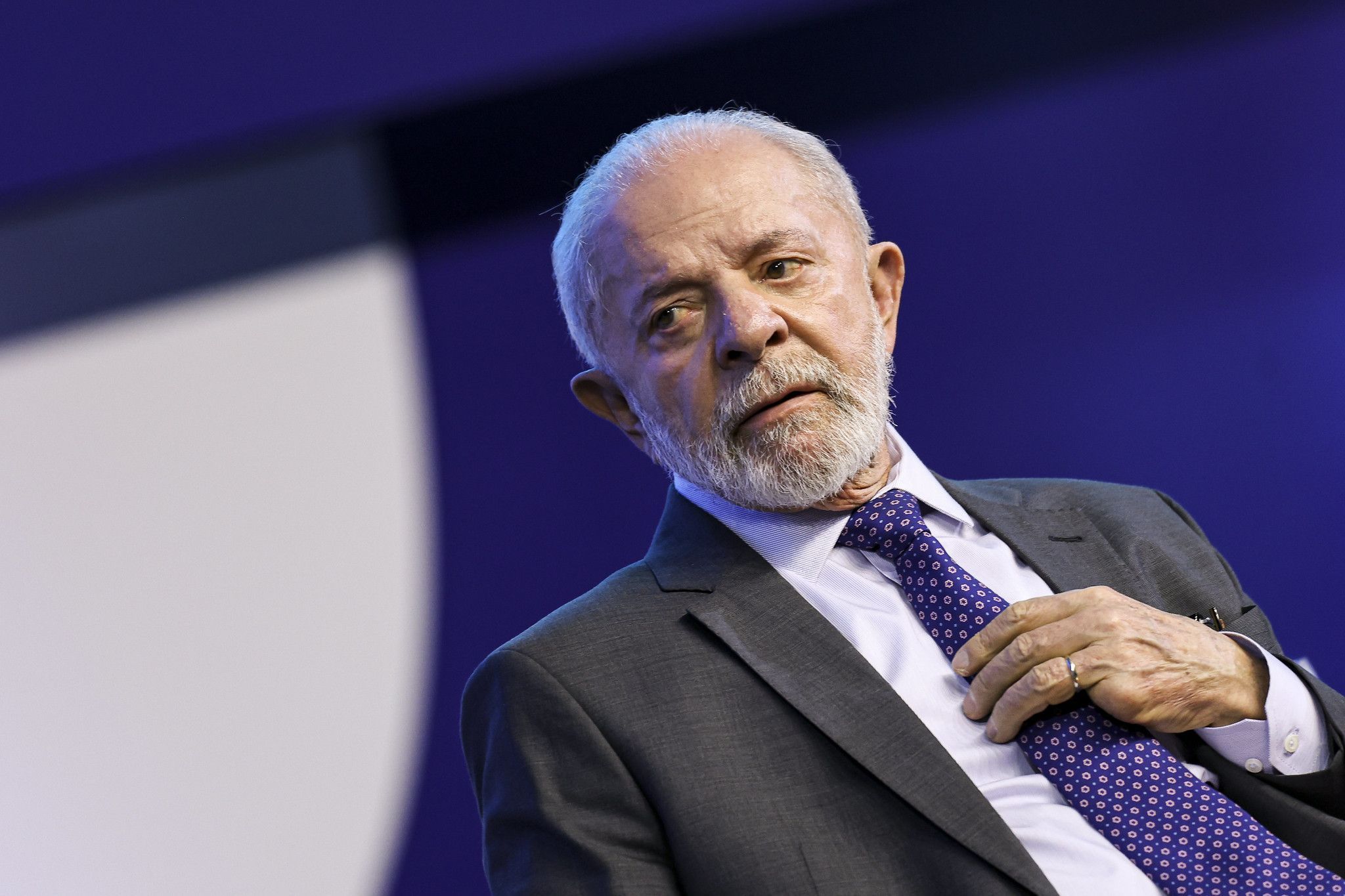 Retirada de dreno da cabeça de Lula acontece 'sem intercorrências'