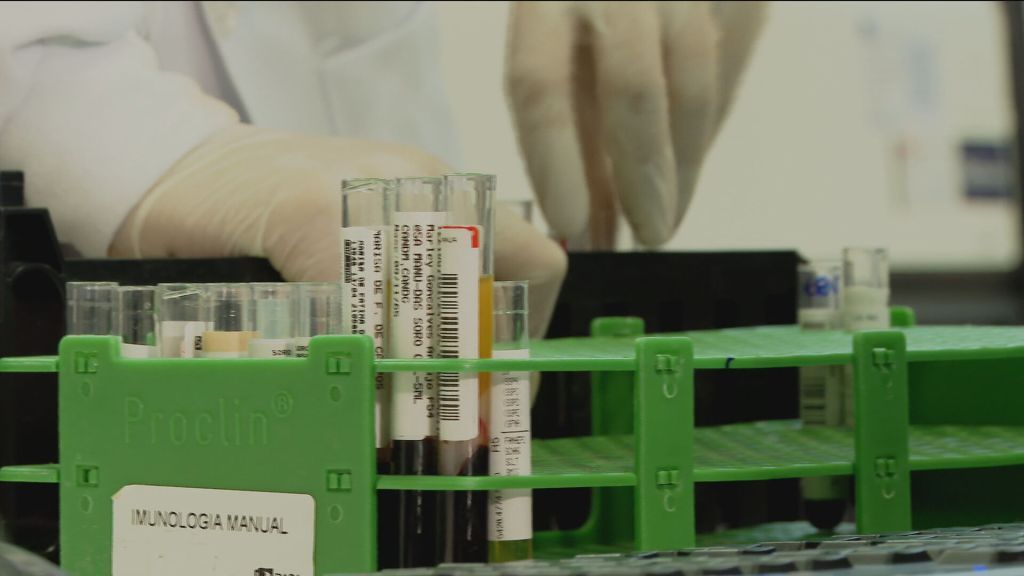 HIV: especialista explica que aumento no número de diagnósticos da doença contribui para evitar transmissão
