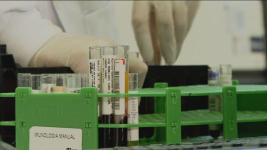 Governo do RJ refaz testes de HIV em 45 transplantados após erros em exames | CNN Brasil