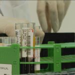 HIV: especialista explica que aumento no número de diagnósticos da doença contribui para evitar transmissão