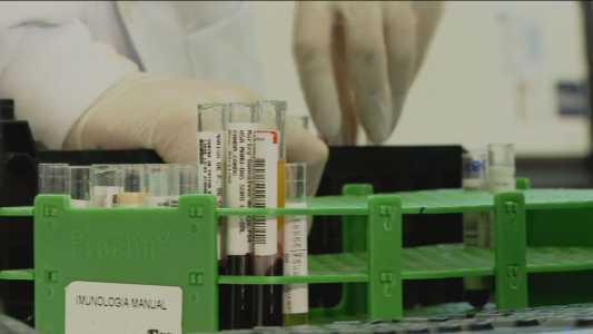 Governo do RJ refaz testes de HIV em 45 transplantados após erros em exames | CNN Brasil