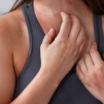 'Marcha dos Atópicos': evento traz conscientização sobre doenças alérgicas neste domingo