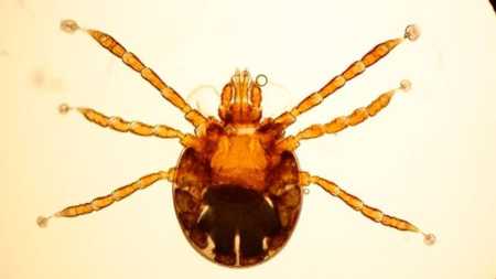A febre maculosa é uma doença infecciosa, causada por uma bactéria transmitida por meio da picada de uma das espécies de carrapato