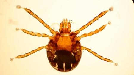 A febre maculosa é uma doença infecciosa, causada por uma bactéria transmitida por meio da picada de uma das espécies de carrapato