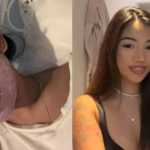 Influenciadora contrai doença após emprestar pincéis de maquiagem e fica com o rosto 'detonado'