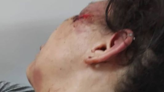 A jovem já foi internada em fevereiro apó ser espancada pelo ex-namorado