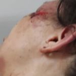 Jovem espancada pelo ex-namorado denuncia ameaças de morte: 'ele vai nos matar'