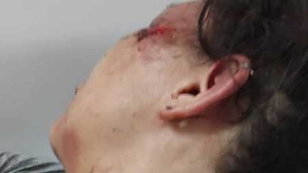 A jovem já foi internada em fevereiro apó ser espancada pelo ex-namorado