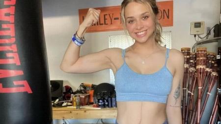 A jovem passou por uma cirurgia no início deste ano