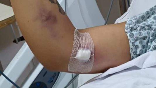 A mãe da vítima relatou que a única coisa feita por médicos enquanto a mão da filha ficava roxa e inchada foi colocar uma bolsa com gel quente no membro