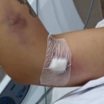 'Esse erro mudou a minha vida', lamenta mulher que deu à luz e teve a mão amputada 