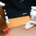 Mulher que teve tatuagem com nome da mãe rasurada durante depilação será indenizada