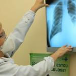 Governo federal cria comitê para eliminar a tuberculose