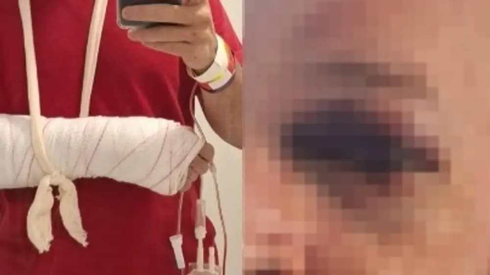 Lutador de MMA suspeito de agredir médico em centro de saúde de BH é preso