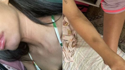 A vítima foi enforcada e ficou com hematomas no corpo