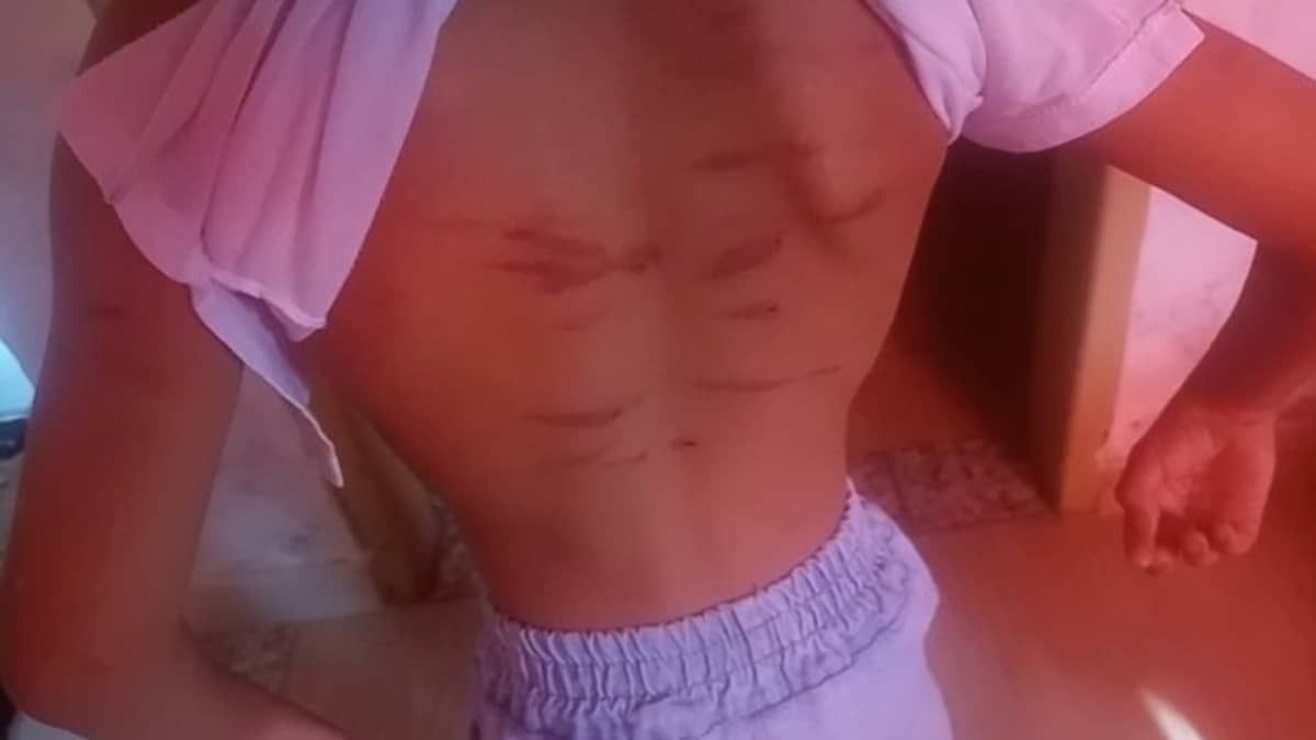 Mãe agride filha de 5 anos com bambu por mau comportamento e é liberada pela polícia em Minas