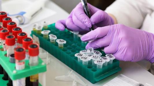 Três casos foram confirmados no estado