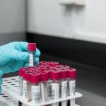 Candida auris: São Paulo confirma primeiro caso de contaminação de superfungo