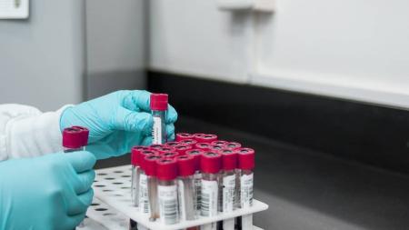 Uma característica da Candida auris é capacidade de resistir aos medicamentos