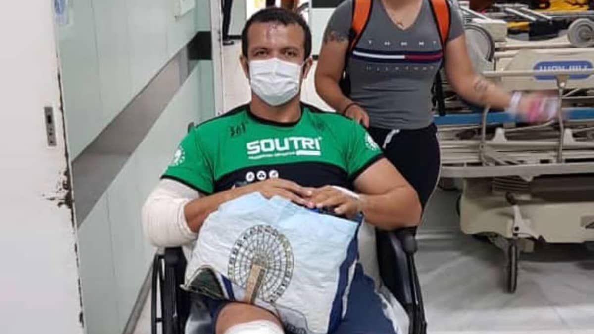 Ciclista atropelado tem alta e perna amputada; motorista disse ter ingerido bebida alcóolica  