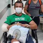 Ciclista atropelado tem alta e perna amputada; motorista disse ter ingerido bebida alcóolica