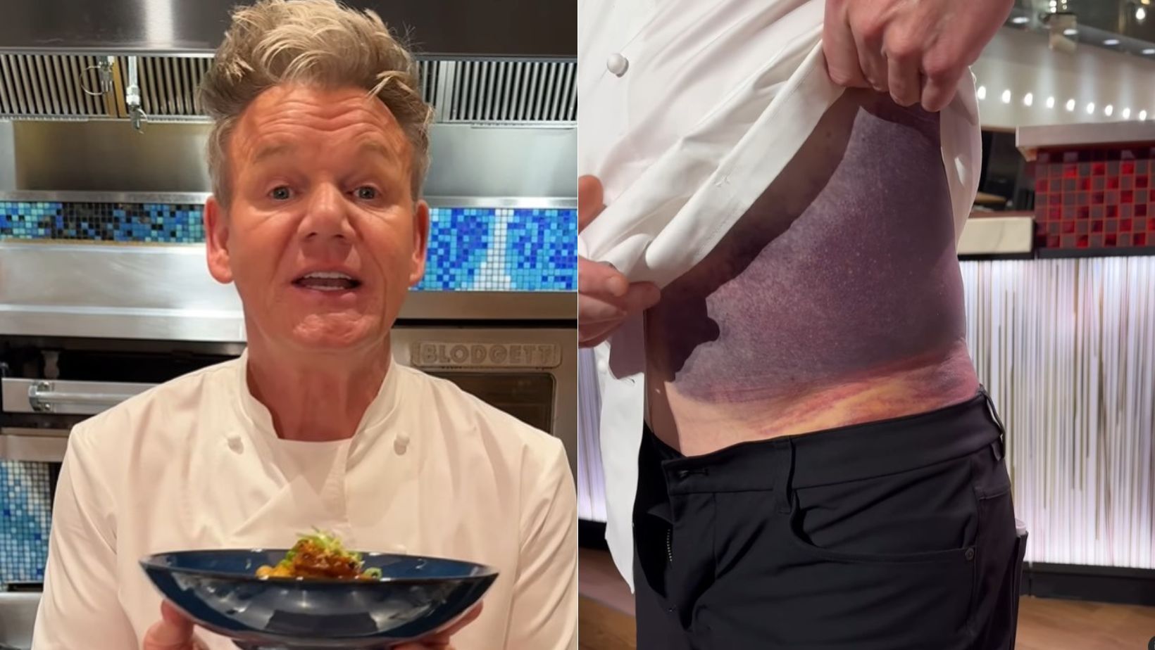 Astro do MasterChef sofre acidente grave e diz que quase morreu: 'Tenho sorte de estar aqui'