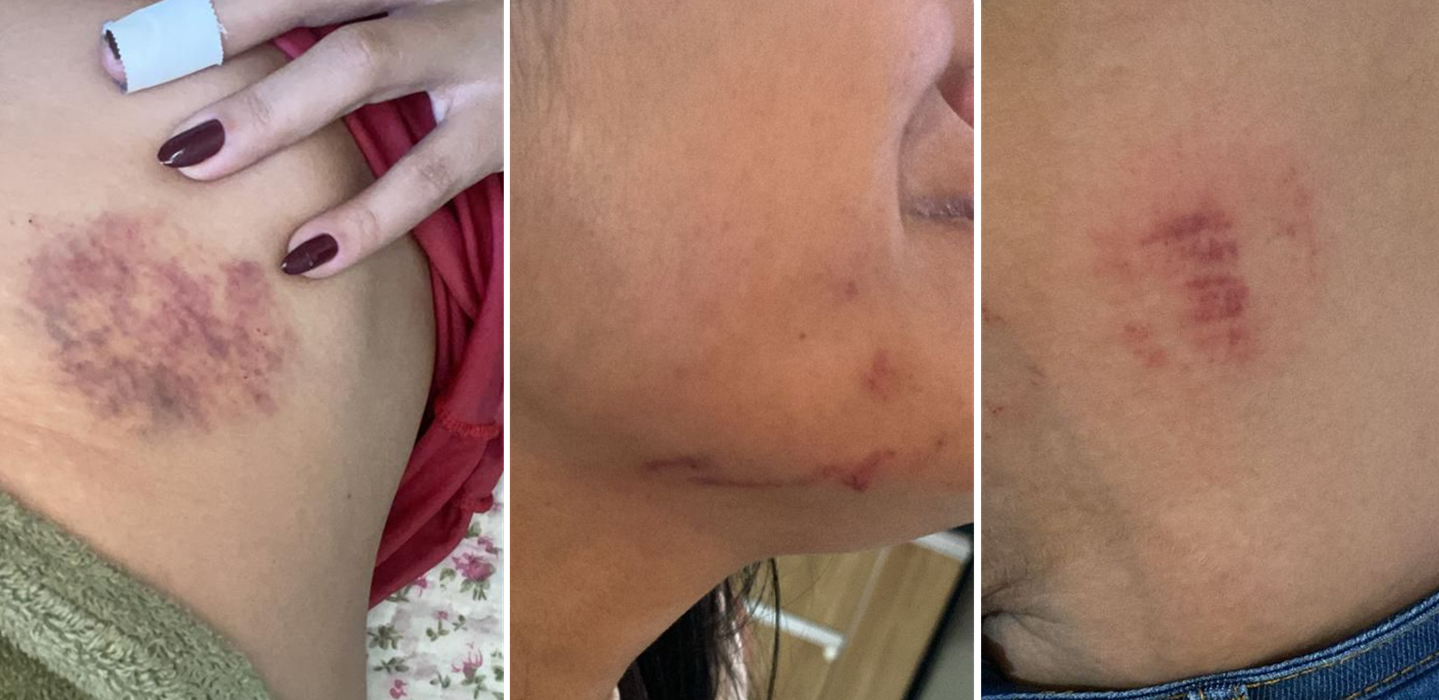 Mulher é espancada pela família do ex-marido na frente dos filhos na Grande BH