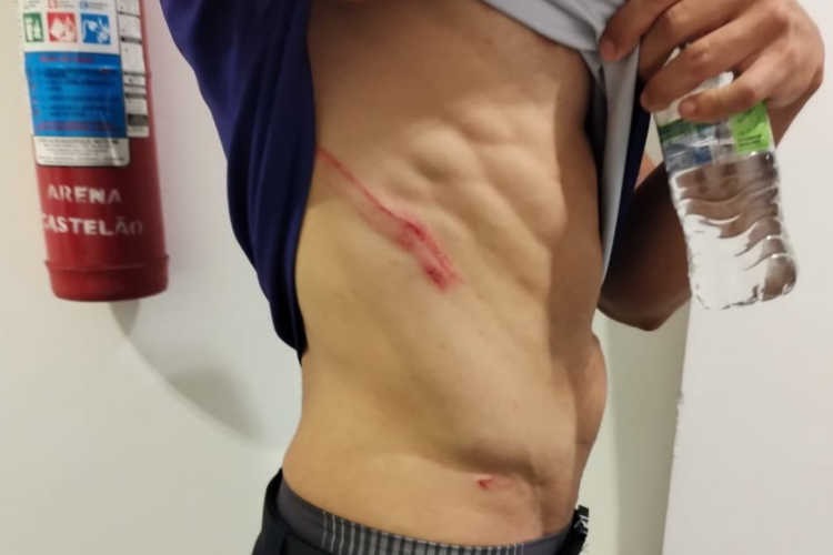 Funcionário do Ceará faz BO e acusa atacante do Fortaleza de agressão