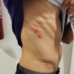 Funcionário do Ceará faz BO e acusa atacante do Fortaleza de agressão