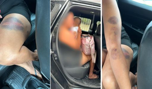 Fotos mostram marcas das agressões sofridas pela vítima em Cuiabá, no Mato Grosso