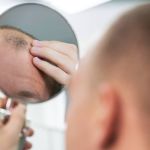 Homem que toma refrigerante todos os dias tem mais chance de ficar careca