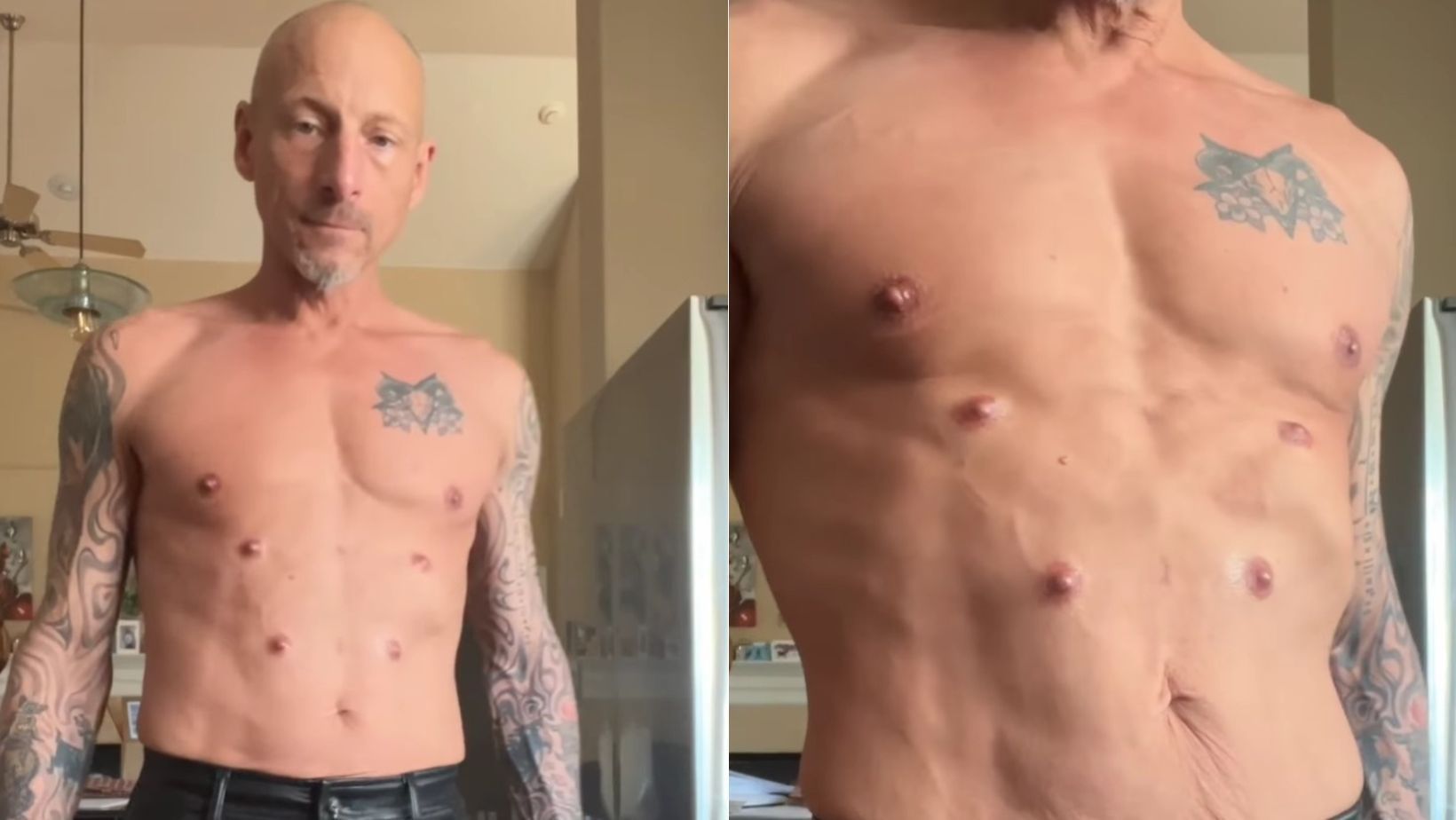 Vídeo: homem de 'seis mamilos' viraliza com implantes de silicone e modificação corporal