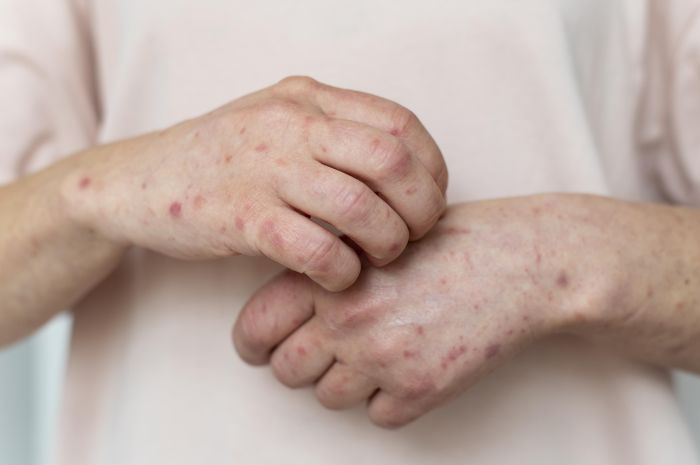 Pessoa com alergia e manchas vermelhas na pele