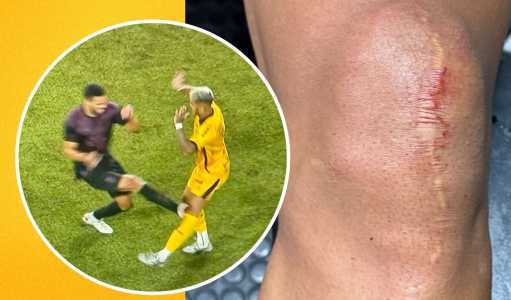 Momento em que Kevin Ramírez é atingido por Alan Kardec em Athletico-PR x Amazonas