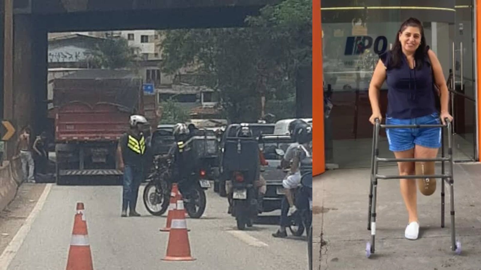 Professora que teve perna esmagada por carreta em BH faz vaquinha para comprar prótese