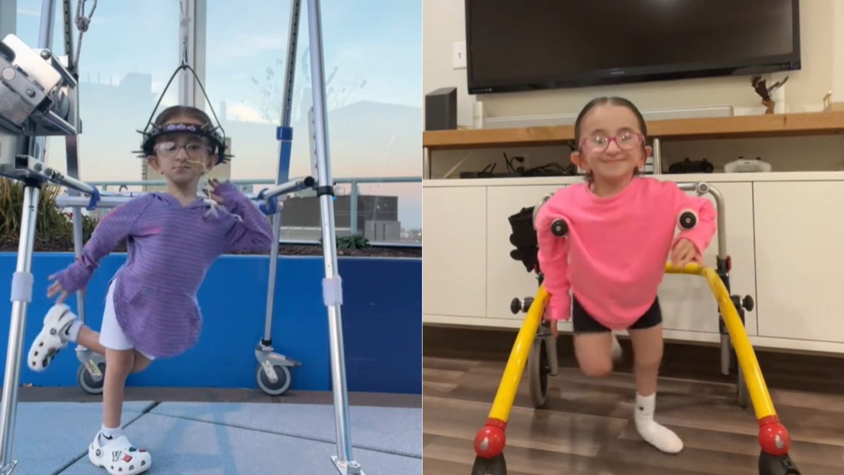 Vídeo: criança de 11 anos com 'ossos de vidro' sofreu quase 50 fraturas, passou por 13 cirurgias e viraliza