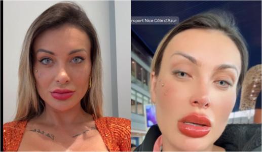Andressa Urach