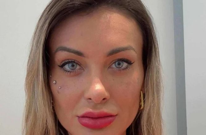 Andressa Urach tem grave problema após cirurgia de mudança de cor nos olhos