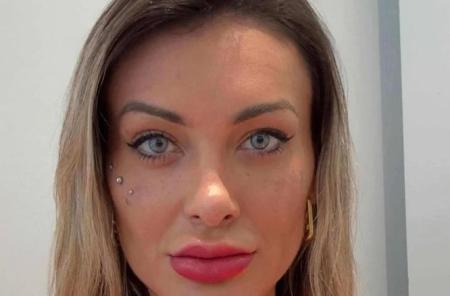 Andressa Urach pós cirurgia
