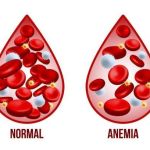 Fabiana de Lemos | Anemia pode esconder câncer de intestino