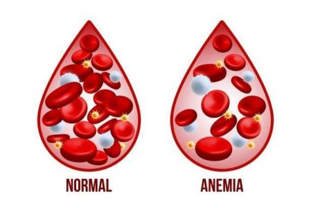 Perda de sangue discreta, porém prolongada, pode gerar o distúrbio de ferro