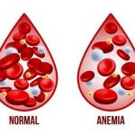 Fabiana de Lemos | Anemia pode esconder câncer de intestino