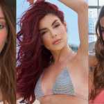Não é só Anitta: cinco famosas que mudaram o rosto e estão irreconhecíveis